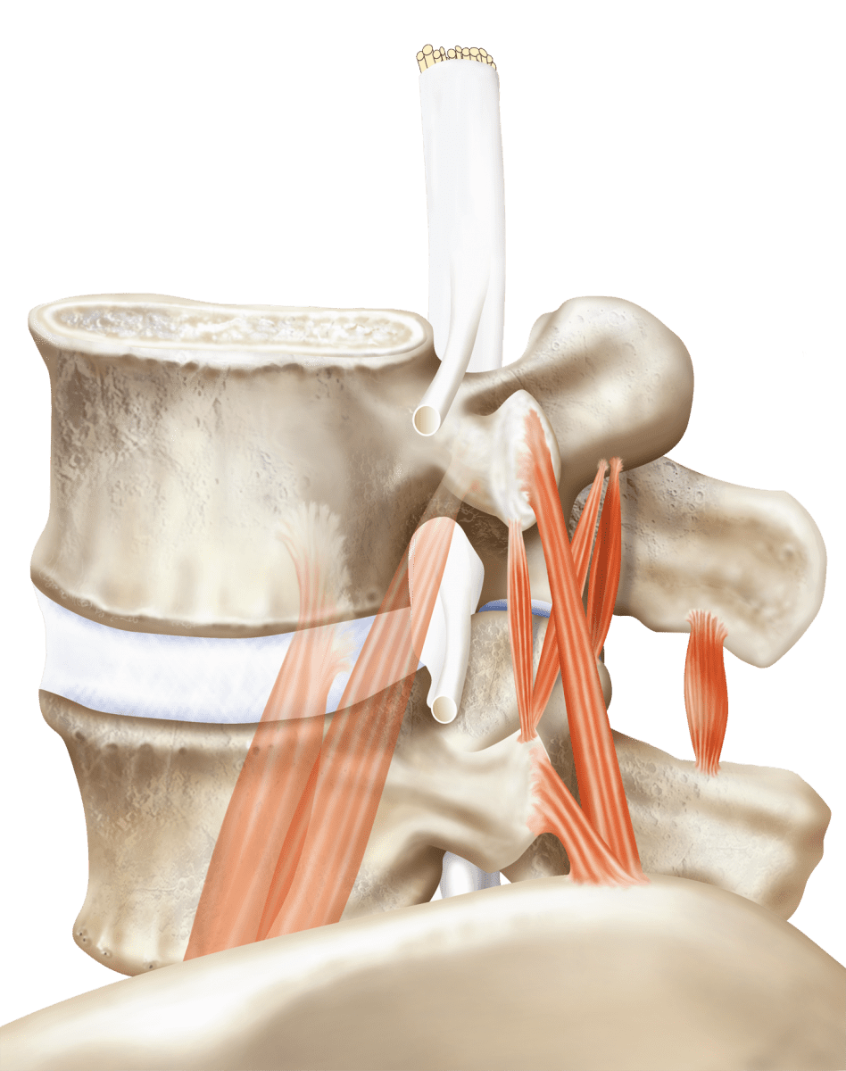 Tense Muscles and Disc Compression